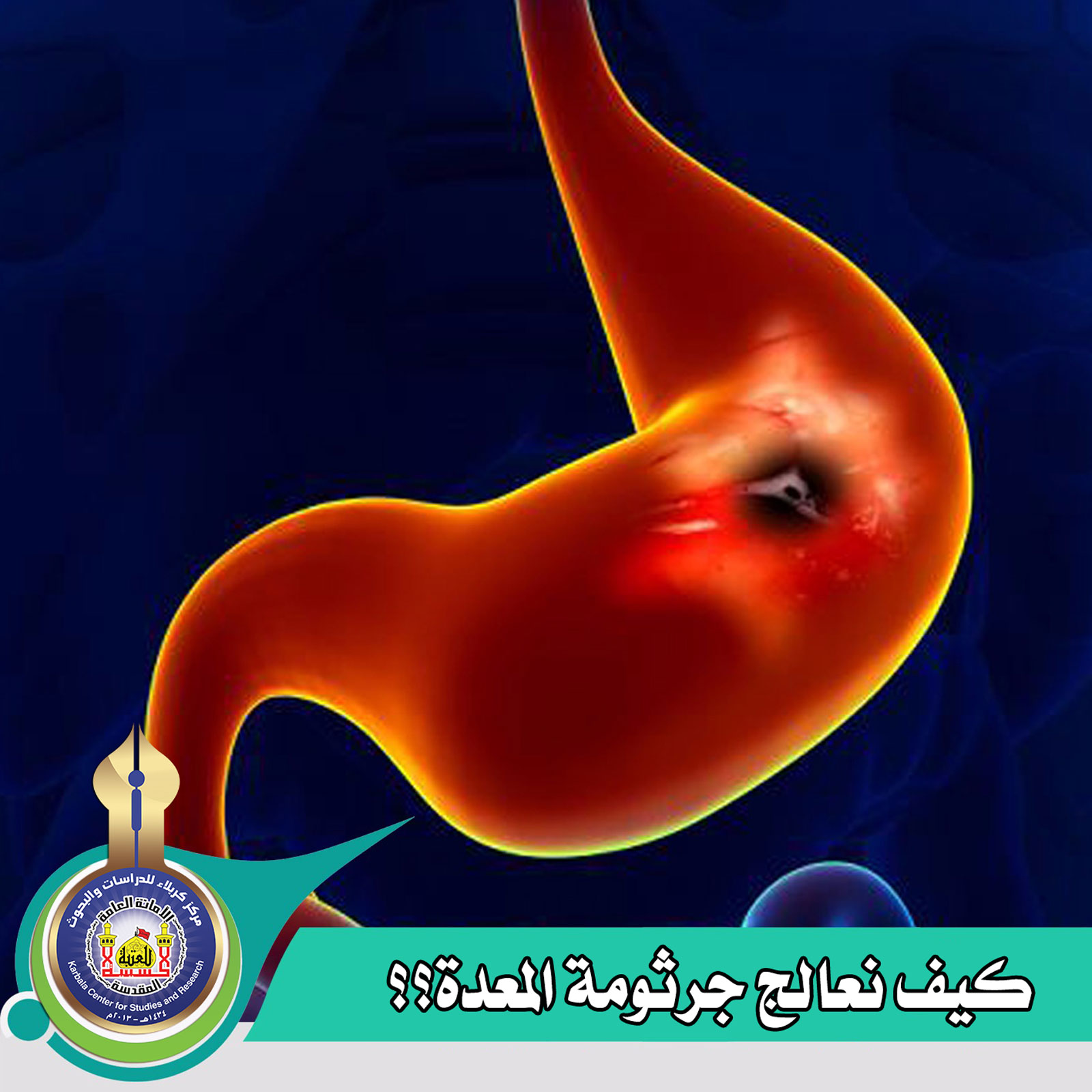 كيف نعالج جرثومة المعدة؟؟