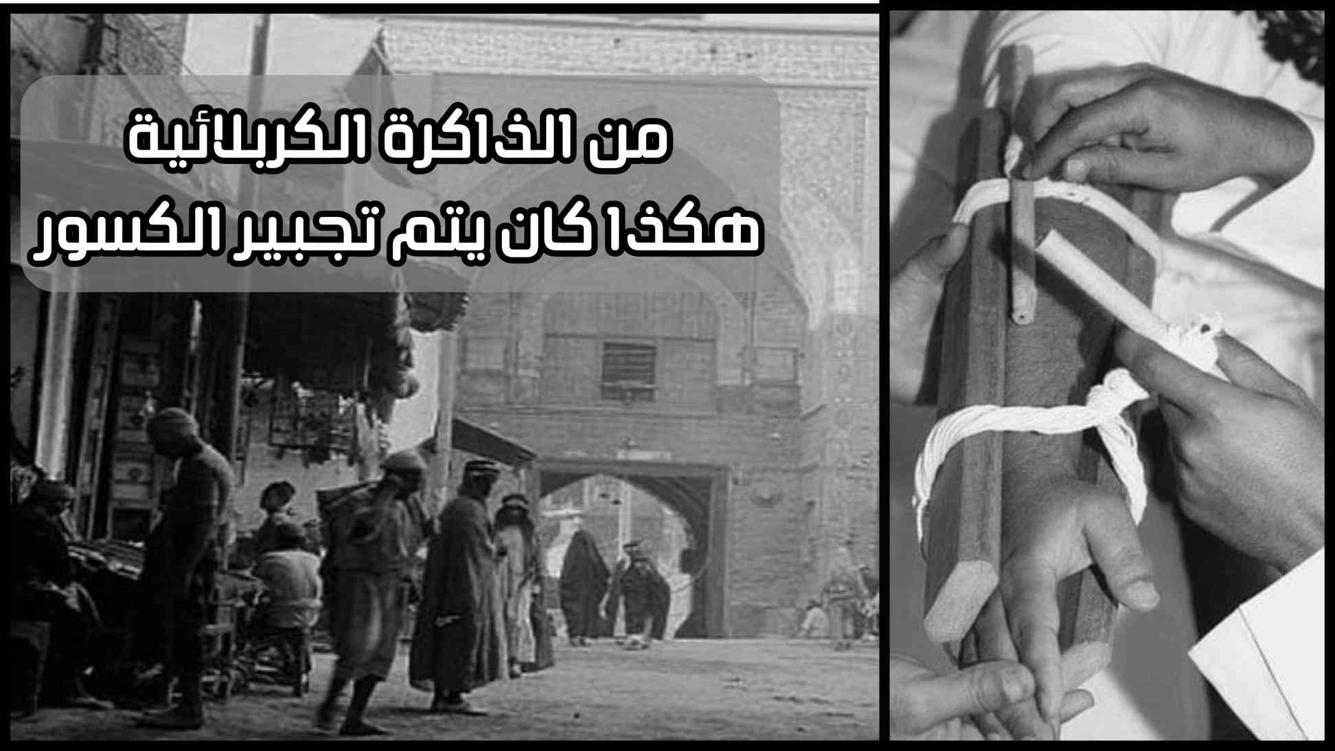 من الذاكرة الكربلائية: هكذا كان يتم تجبير الكسور